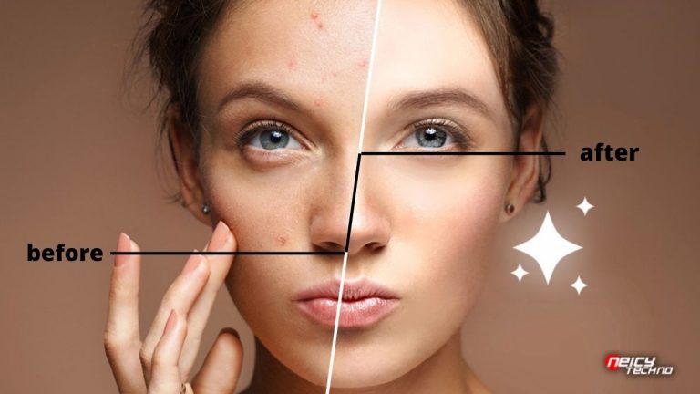 Situs Edit Foto Menghilangkan Jerawat Online Terbaik